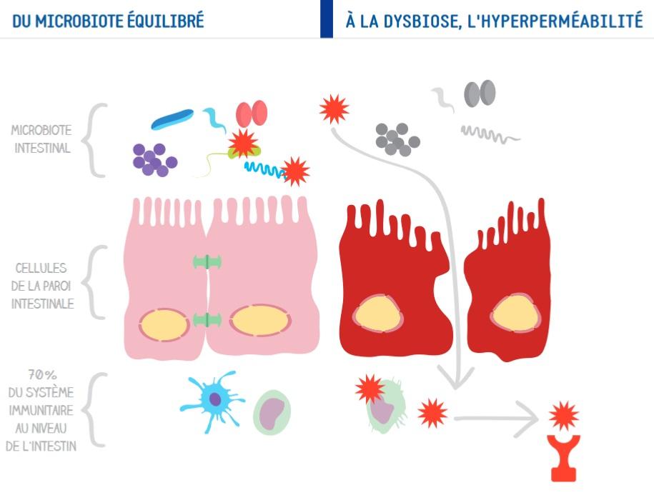 Du microbiote quilibr  la dysbiose et l'hyperpermabilit